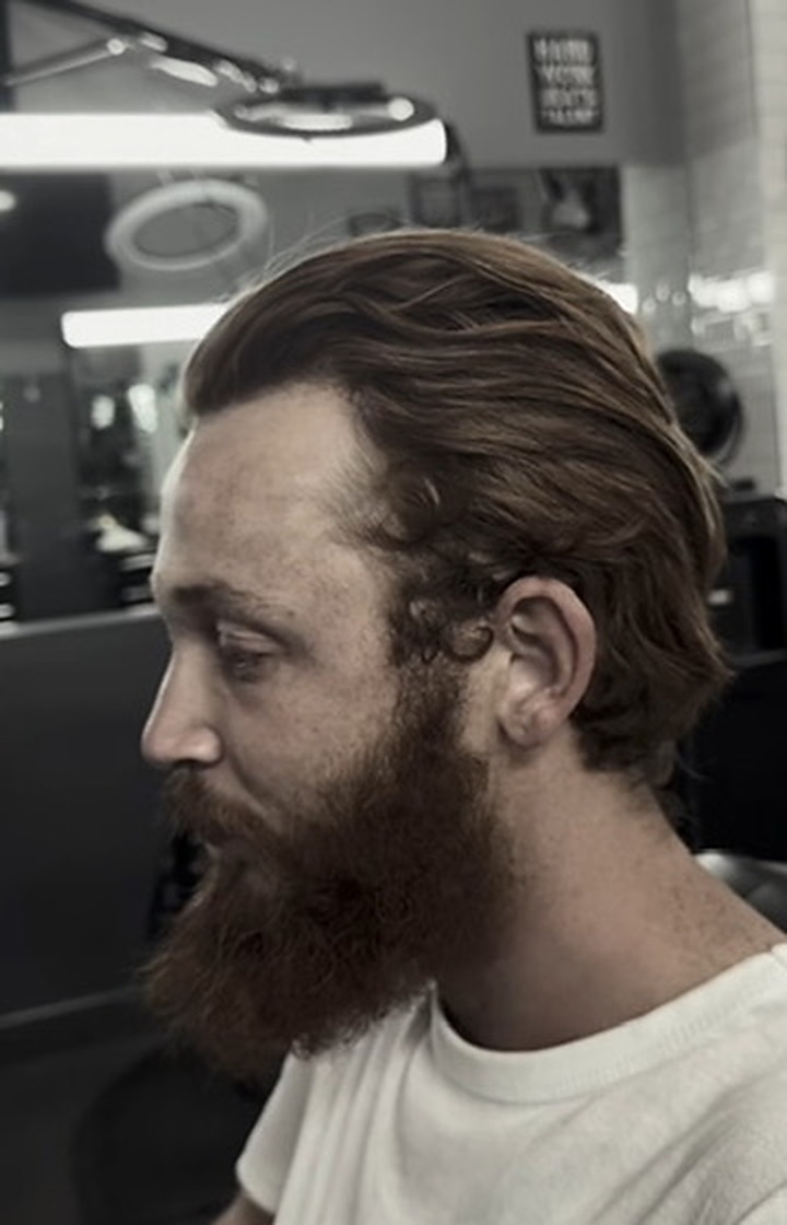 Before left profile